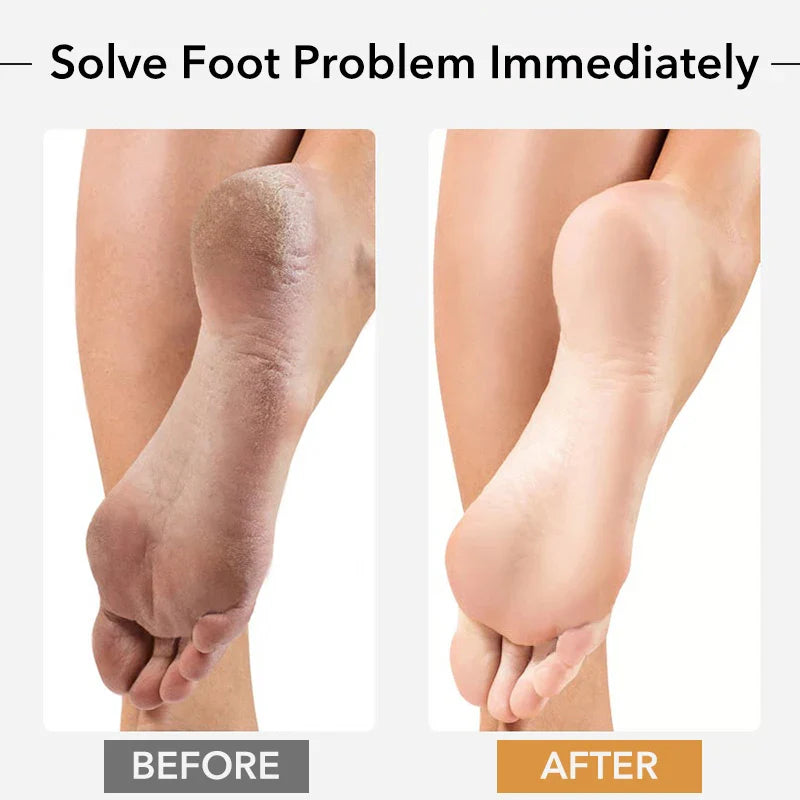 1PCS Professional Pedicure Rasp Tool for Dead Skin Crack Heels Beech Wood Foot File Rasp Callus Remover Foot Scrubber